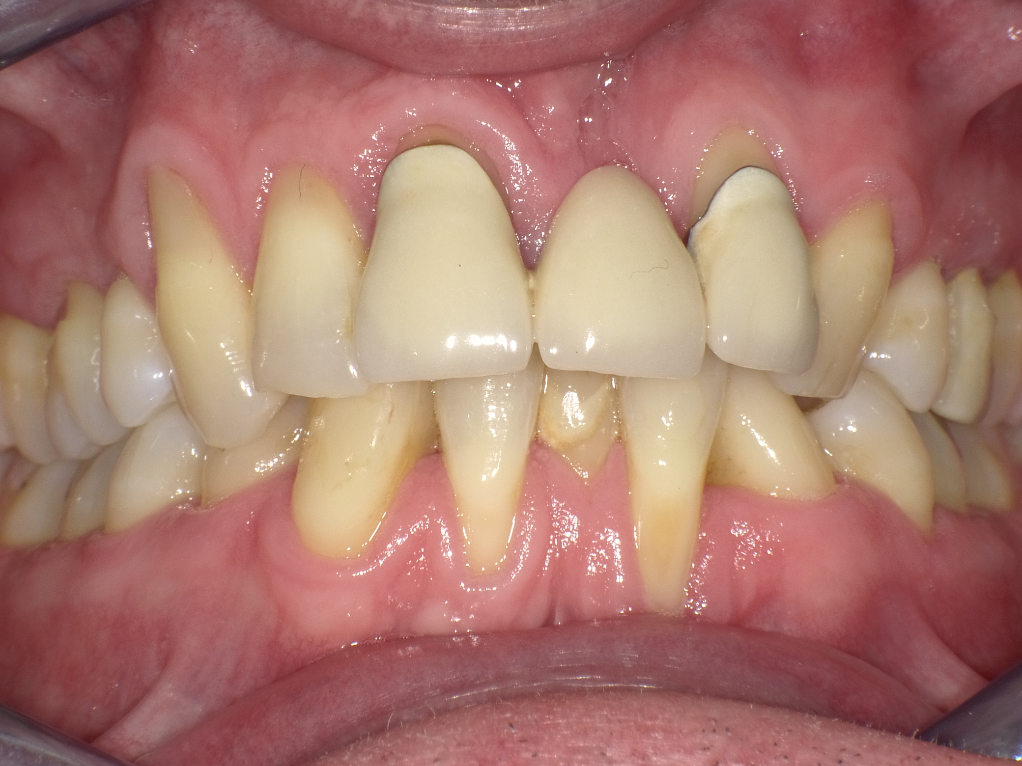 Eine etwas suboptimale Ausgangssituation